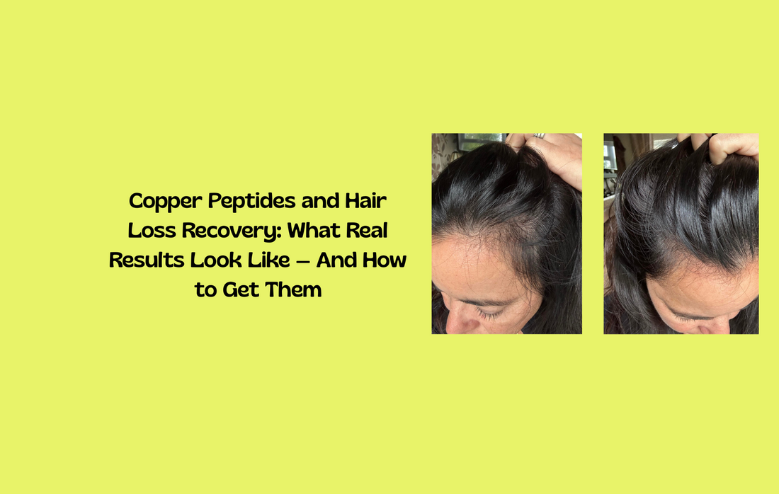 Before and after images of hair recovery with copper peptides, showing visible results from consistent use.