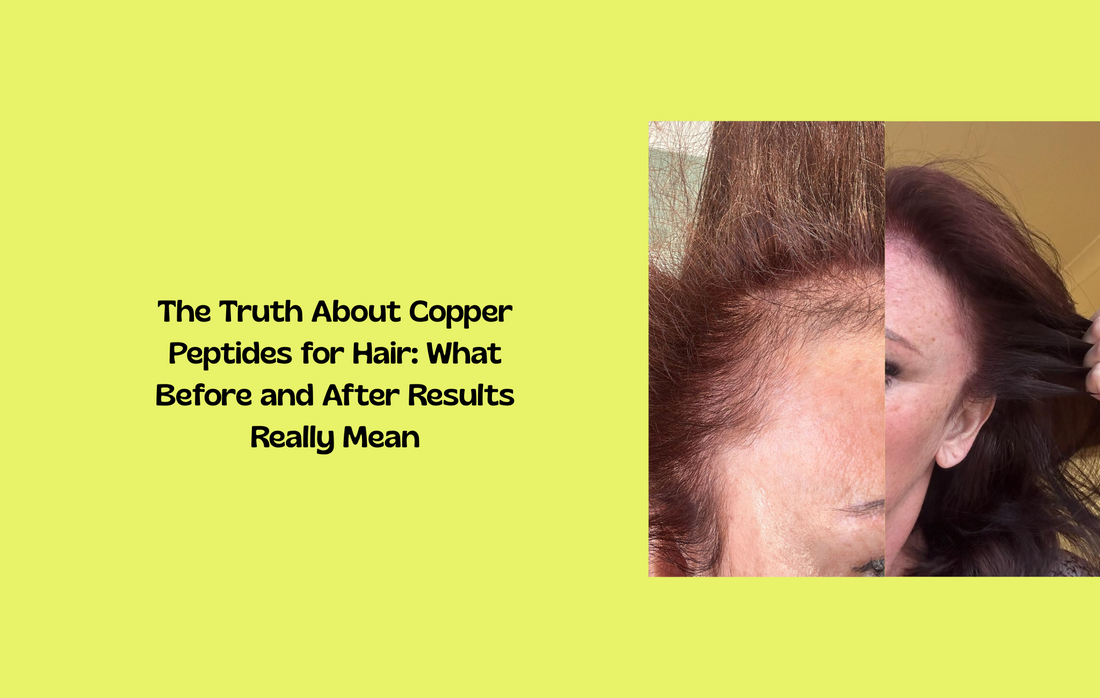 Before and after hair images with copper peptide icons, revealing real results and effectiveness for hair growth.