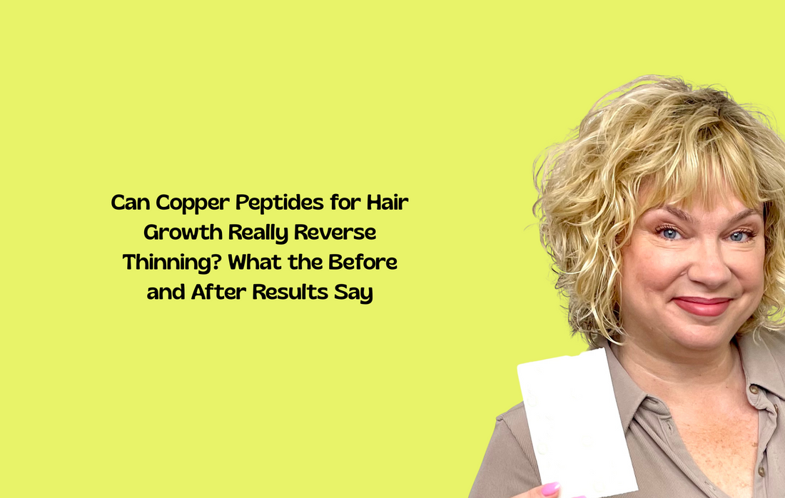Thinning vs. fuller hair images with copper peptides, illustrating potential reversal of hair loss through treatment.