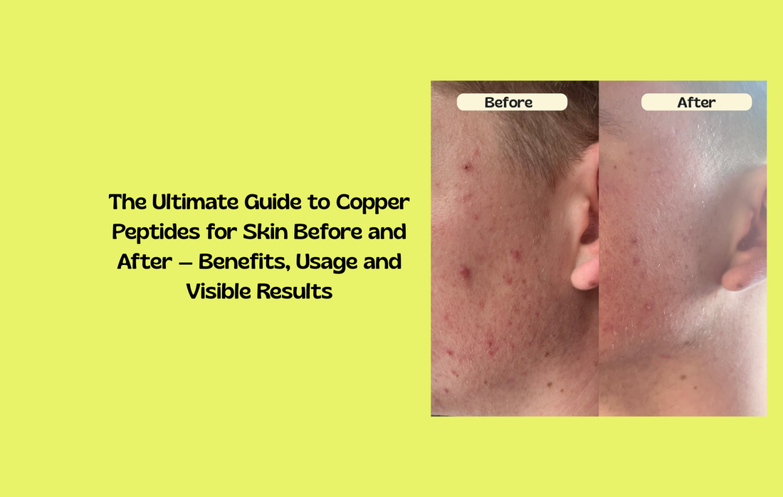 Glow Up copper peptide patch for visible skin results