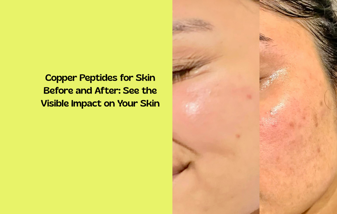 Visible skin results from copper peptide patches
