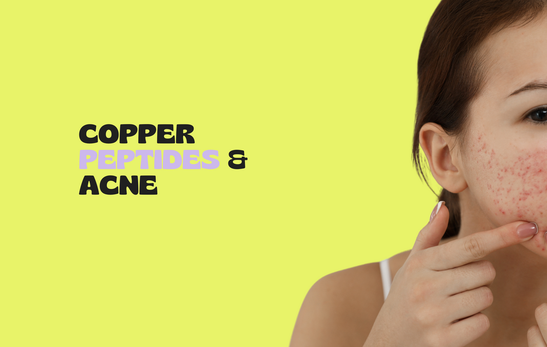 Can Copper Peptides Combat Acne?