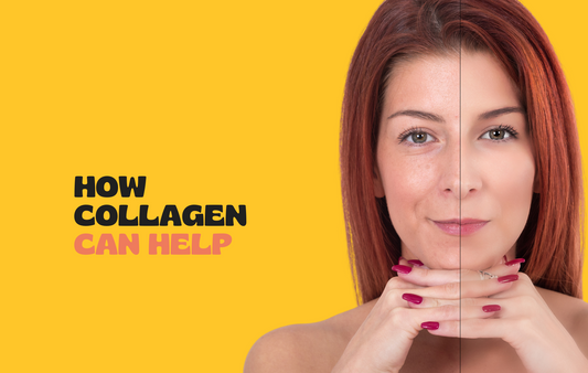 How Does Collagen Help You?
