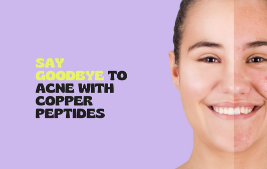 Say Goodbye to Acne Using Copper Peptide Patches