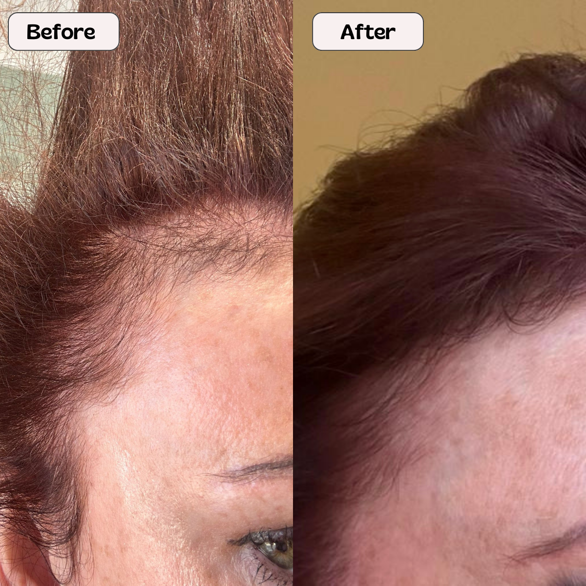 Collagen Ultra Gummies