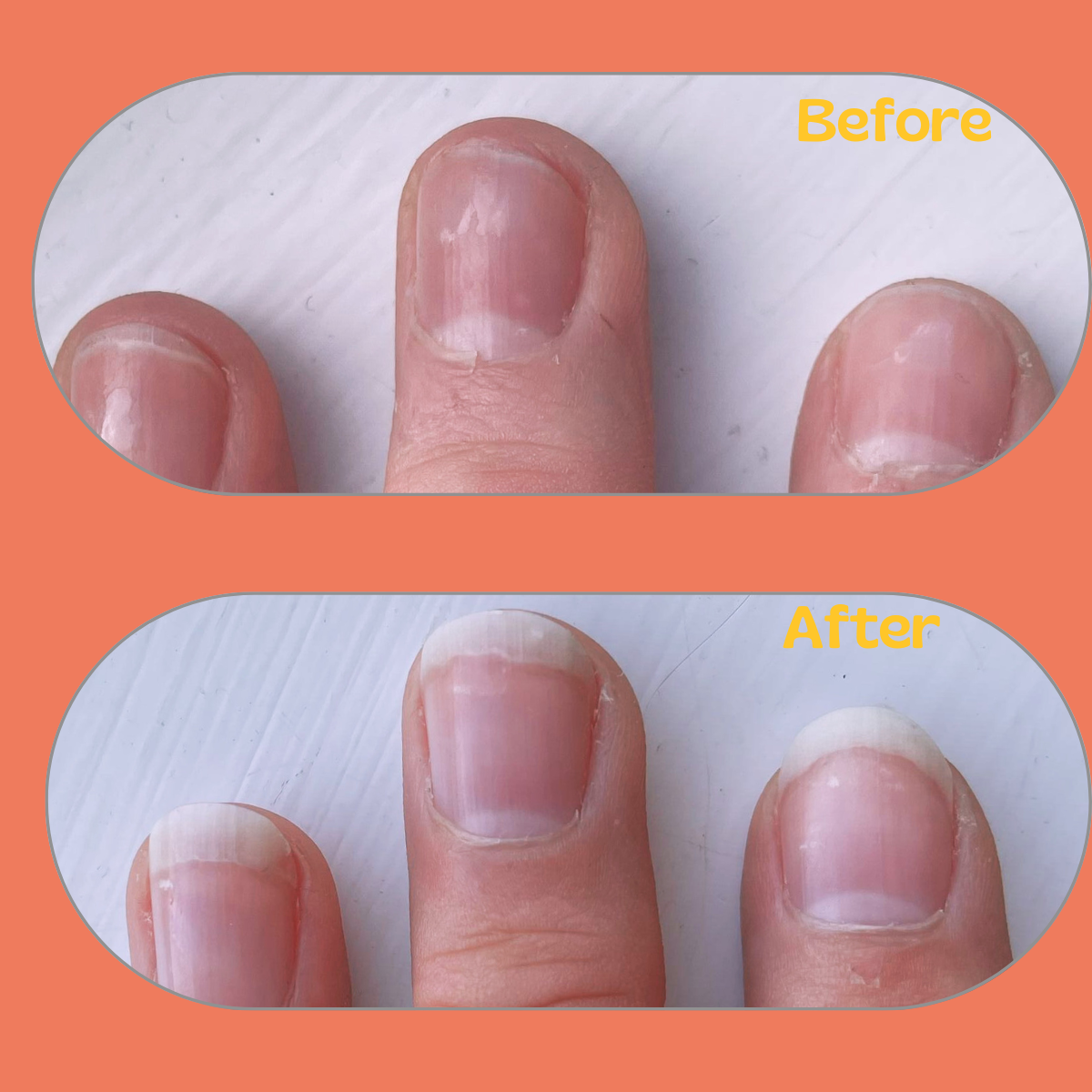 Collagen Ultra Gummies