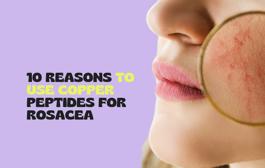 Reasons to Use Copper Peptide Patches to Treat Rosacea
