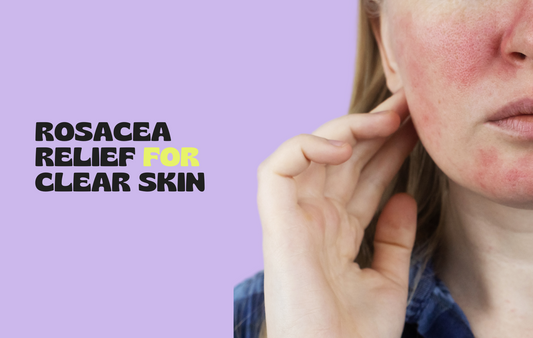 Rosacea Relief with Copper Peptide Patches