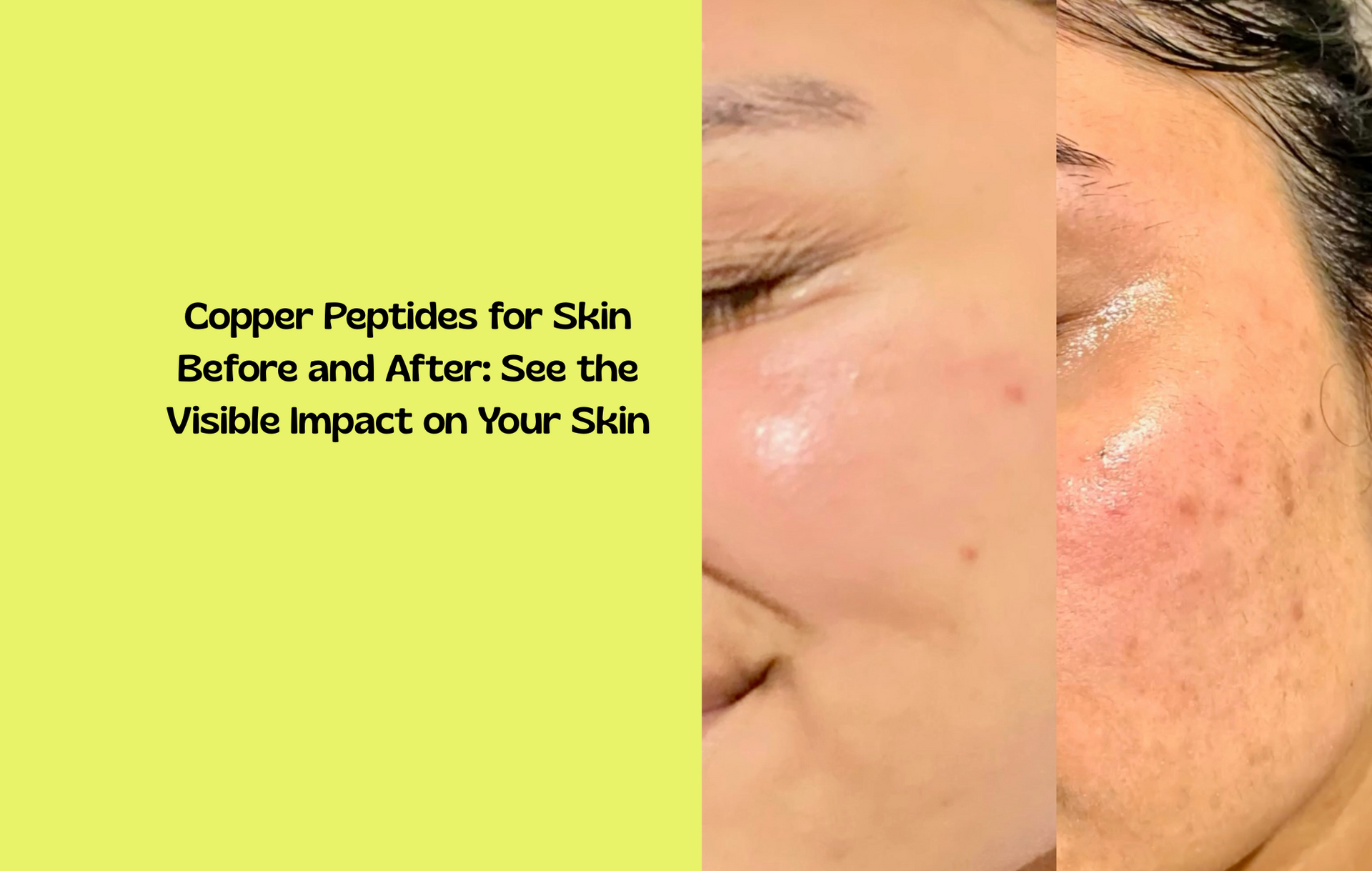 Copper Peptides for Skin Before and After: See the Visible Impact on Y HapiPatch Copper Peptides for Skin Before and After: See the Visible Impact on Y HapiPatch