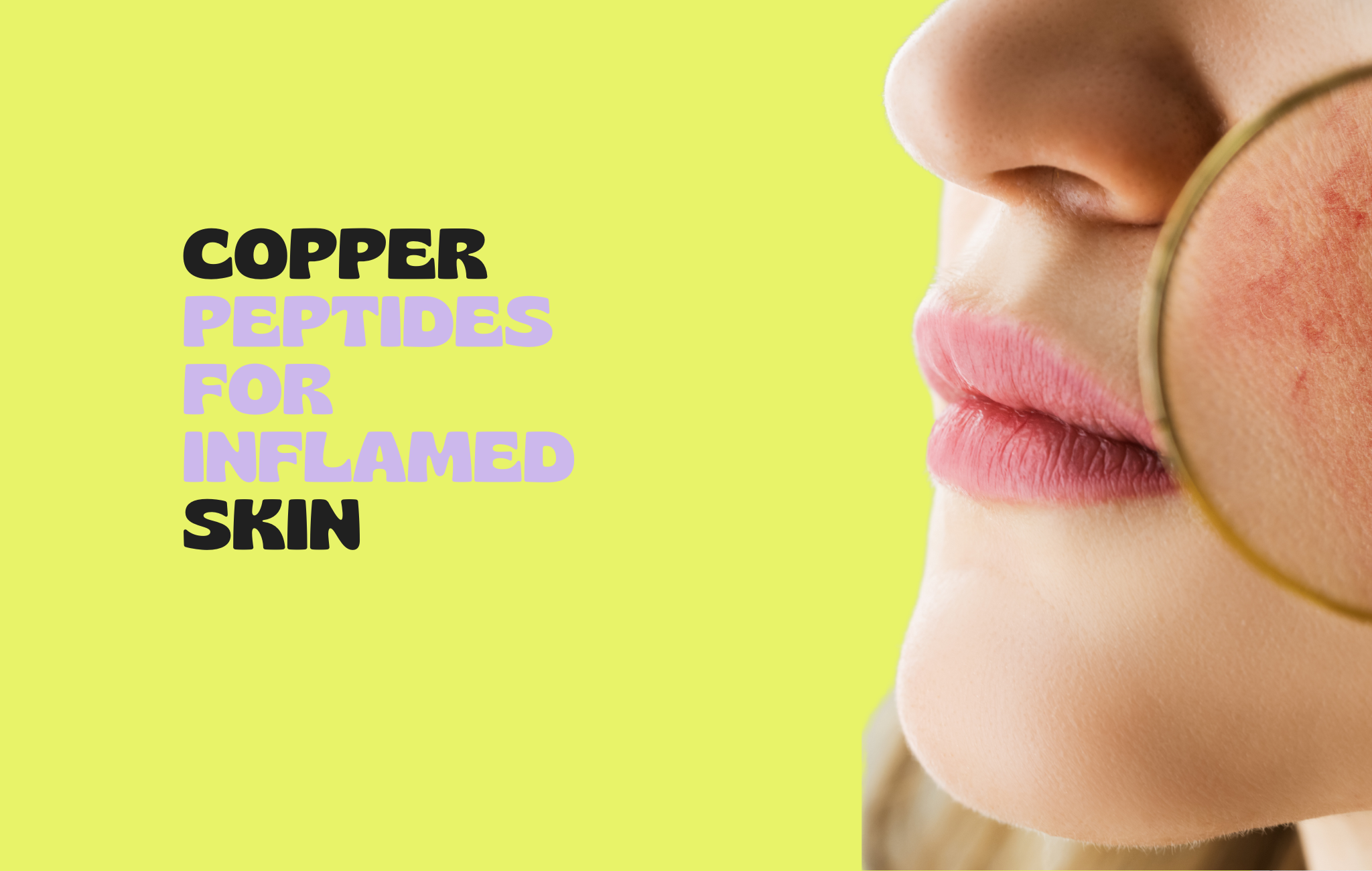 How Copper Peptides Can Help Treat Inflamed Skin | HapiPatch.com