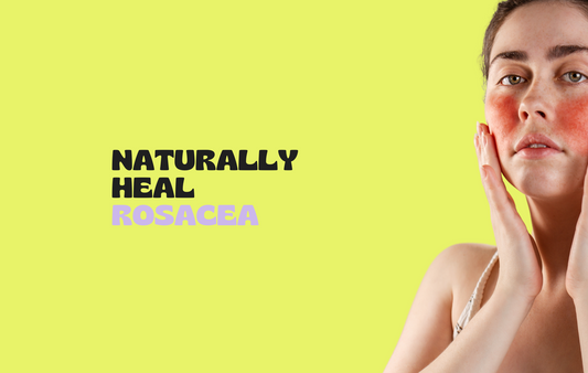 How to Naturally Heal Inflamed Skin Caused by Rosacea