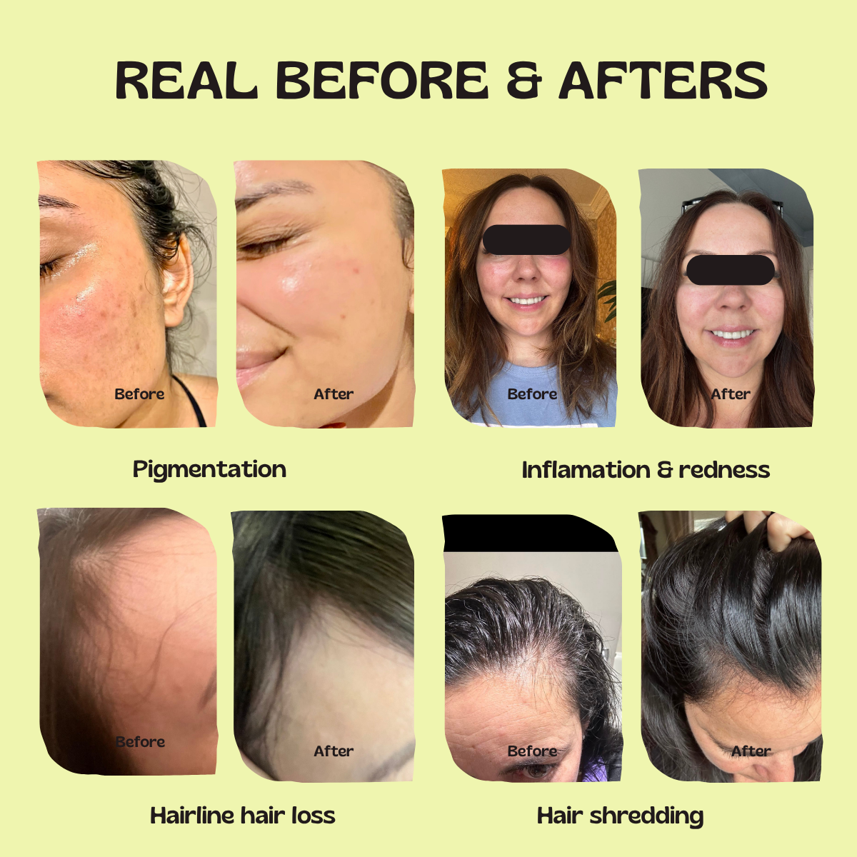 Glow Up GHK-Cu Copper Peptide Patches