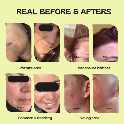 Glow Up GHK-Cu Copper Peptide Patches