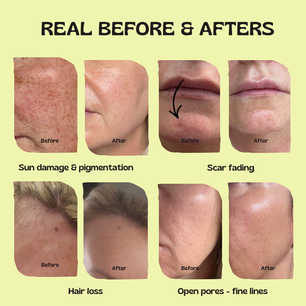 Glow Up GHK-Cu Copper Peptide Patches