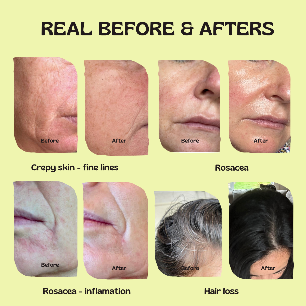 Glow Up GHK-Cu Copper Peptide Patches