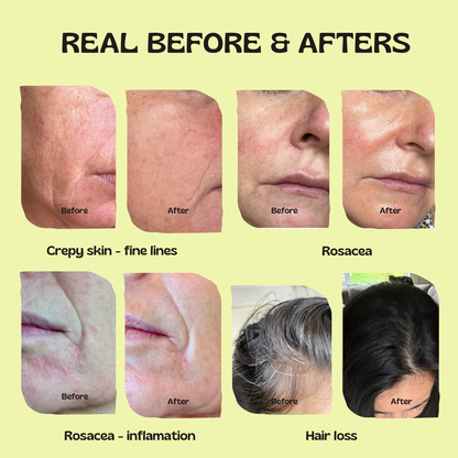 Glow Up GHK-Cu Copper Peptide Patches
