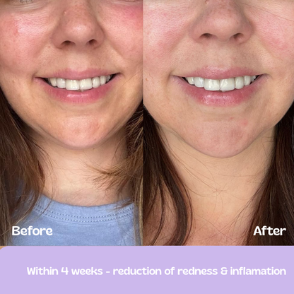 Glow Up GHK-Cu Copper Peptide Patches