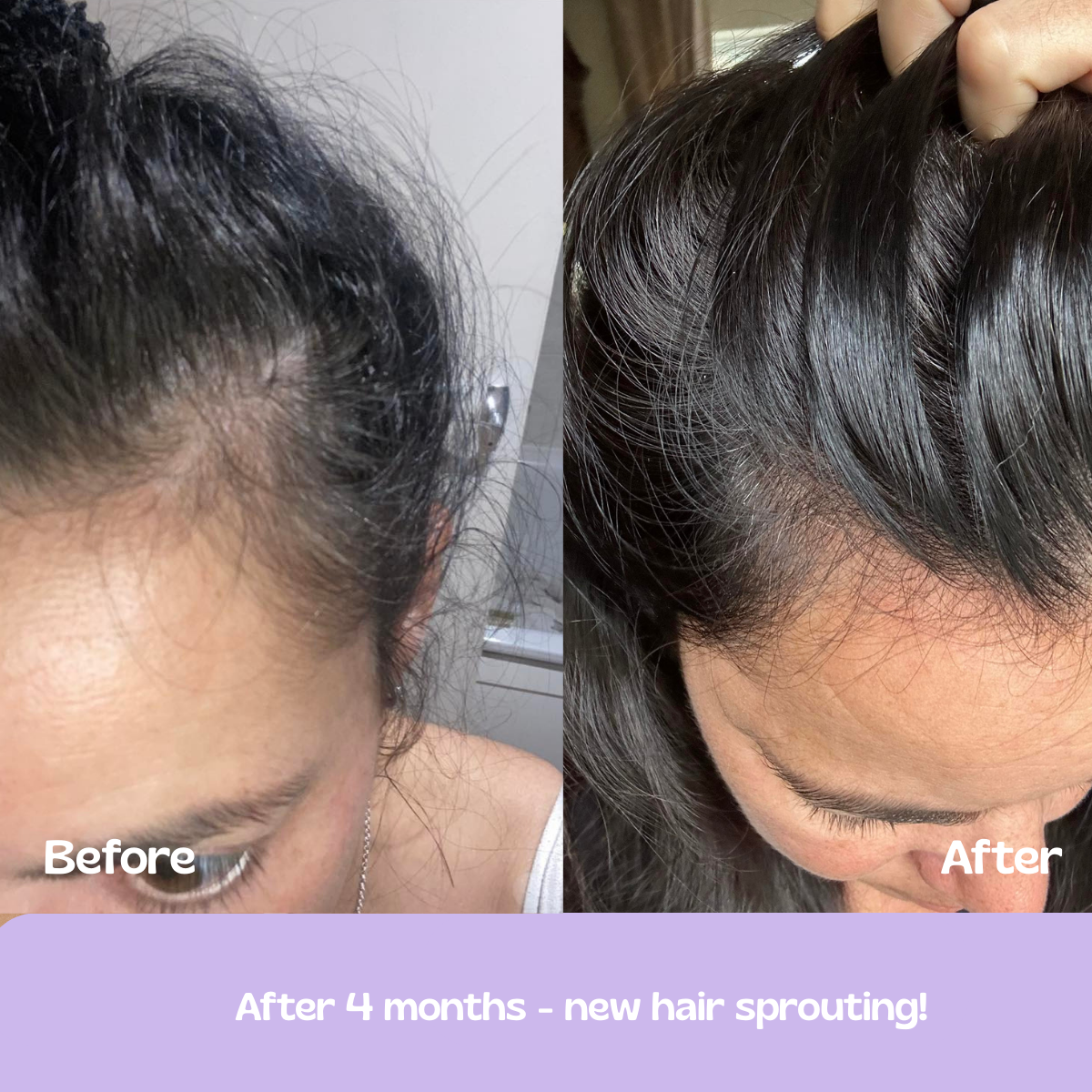 Glow Up GHK-Cu Copper Peptide Patches