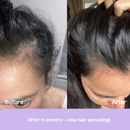 Glow Up GHK-Cu Copper Peptide Patches