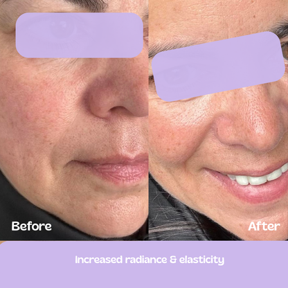 Glow Up GHK-Cu Copper Peptide Patches