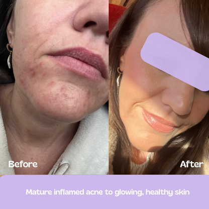 Glow Up GHK-Cu Copper Peptide Patches