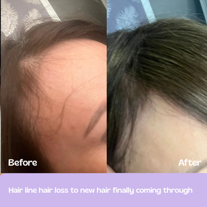 Glow Up GHK-Cu Copper Peptide Patches