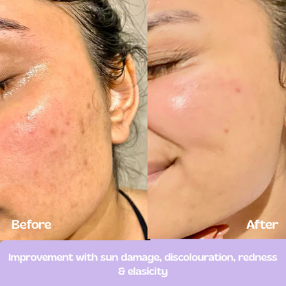 Glow Up GHK-Cu Copper Peptide Patches