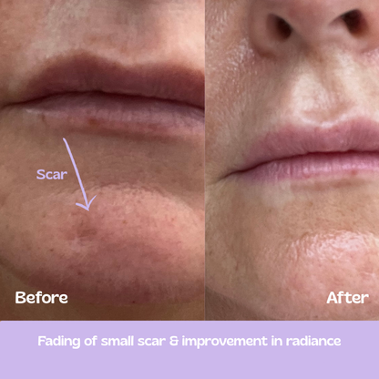 Glow Up GHK-Cu Copper Peptide Patches