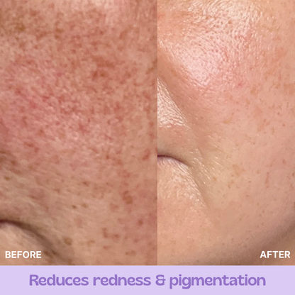 Glow & Growth Restore Bundle - Save £25!